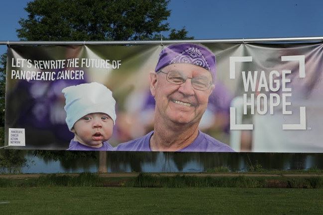Pancreatic Cancer Sign